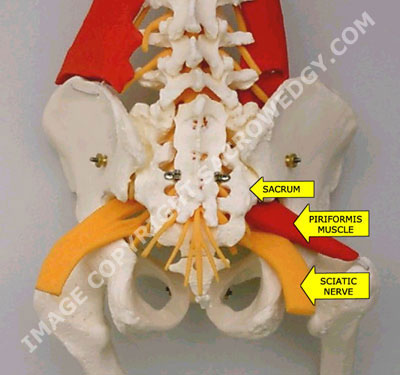 Pain In Sacrum